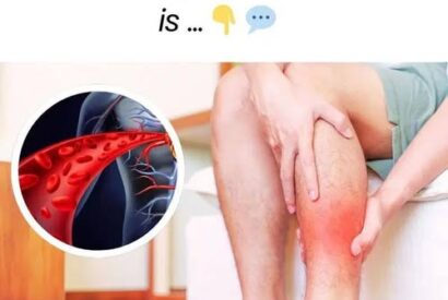Thumbnail for One vitamin that opens blood vessels and improves circulation