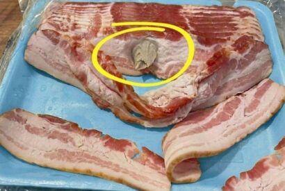 Thumbnail for That “Weird Lump” ? Here’s What It Really Is (And Why You Don’t Need to Panic)