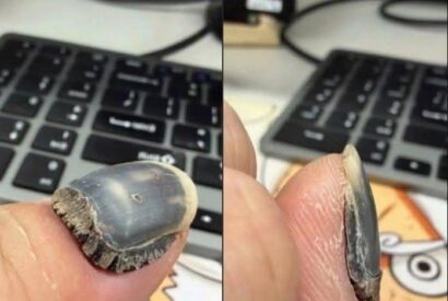 Thumbnail for These are the consequences of using too much n… See more