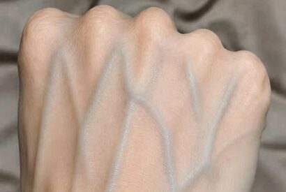 Thumbnail for VEINS REVEALED: THE SHOCKING TRUTH ABOUT YOUR BODY’S SECRET WARNING SIGNS