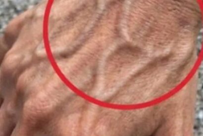Thumbnail for If Your Hand Veins Are Visible Here’s What Your Body May Be Telling You