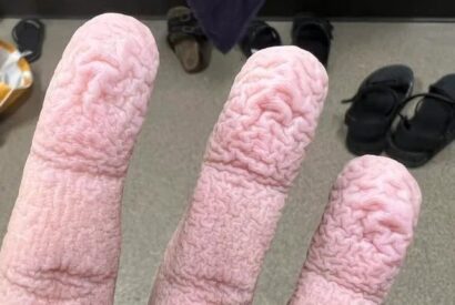 Thumbnail for Wrinkled Fingers After Water Exposure: What Your Skin May Be Telling You