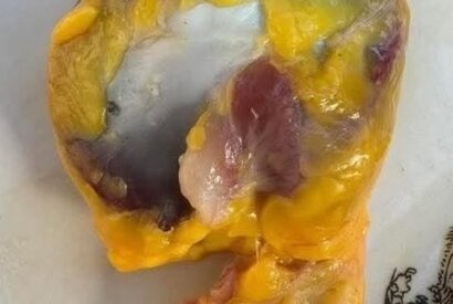 Thumbnail for Did you know that if you eat chicken gizzards you don’t have to take…See More.