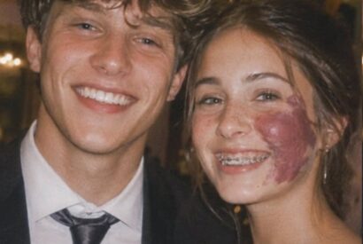 Thumbnail for Only One Boy Asked Me To Prom Because Of My Birthmark—Until An Officer Walked In