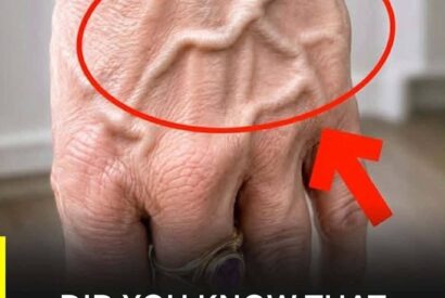 Thumbnail for Did you know that having visible veins means you are… See more