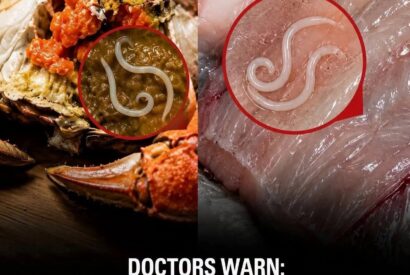Thumbnail for 4 Common Foods That May Hide Parasites — Doctors Say You Should Know This Before Eating. ⚠️