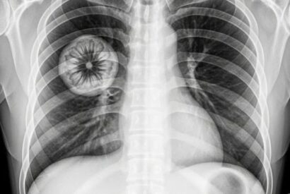 Thumbnail for Warning: People vaccinated against COVID-19 could…See more