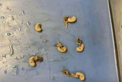 Thumbnail for Hidden Seeds Food Warning