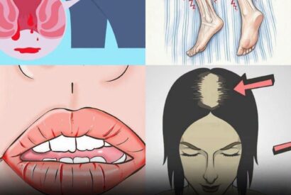 Thumbnail for Common Signs of Low Vitamin B12