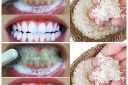 Thumbnail for  Teeth Whitening Trick with Rice — A Natural, 1-Minute Smile Brightener (Or Cautionary Tale?)