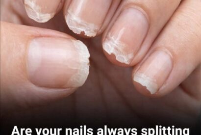 Thumbnail for Brittle or fragile nails: what your body is trying to tell you